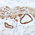 TPM2 Antibody in Immunohistochemistry (Paraffin) (IHC (P))