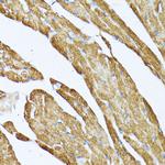 TPM2 Antibody in Immunohistochemistry (Paraffin) (IHC (P))