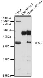 TPM2 Antibody in Immunoprecipitation (IP)