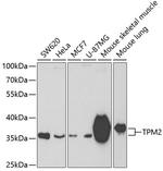 TPM2 Antibody in Western Blot (WB)