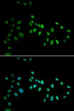 DNMT3A Antibody in Immunocytochemistry (ICC/IF)