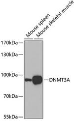 DNMT3A Antibody in Western Blot (WB)