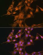 ELOVL4 Antibody in Immunocytochemistry (ICC/IF)