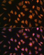 ELOVL4 Antibody in Immunocytochemistry (ICC/IF)