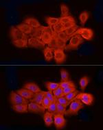 ELOVL4 Antibody in Immunocytochemistry (ICC/IF)