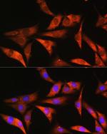 Aldolase B Antibody in Immunocytochemistry (ICC/IF)