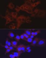 Aldolase B Antibody in Immunocytochemistry (ICC/IF)