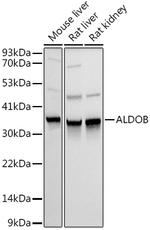 Aldolase B Antibody in Western Blot (WB)