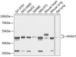 Annexin A7 Antibody in Western Blot (WB)