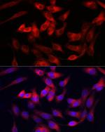 Collagen III Antibody in Immunocytochemistry (ICC/IF)