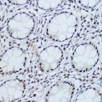 DDB1 Antibody in Immunohistochemistry (Paraffin) (IHC (P))