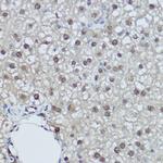 DDB1 Antibody in Immunohistochemistry (Paraffin) (IHC (P))