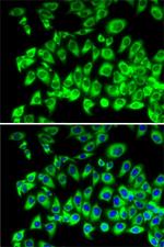 RPL13 Antibody in Immunocytochemistry (ICC/IF)