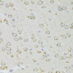 RPL13 Antibody in Immunohistochemistry (Paraffin) (IHC (P))