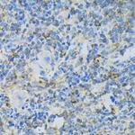 RPL13 Antibody in Immunohistochemistry (Paraffin) (IHC (P))