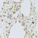 RPL13 Antibody in Immunohistochemistry (Paraffin) (IHC (P))