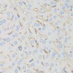 IFITM1 Antibody in Immunohistochemistry (Paraffin) (IHC (P))