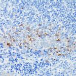 IFITM1 Antibody in Immunohistochemistry (Paraffin) (IHC (P))