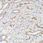 IFITM1 Antibody in Immunohistochemistry (Paraffin) (IHC (P))