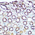 ATP5H Antibody in Immunohistochemistry (Paraffin) (IHC (P))