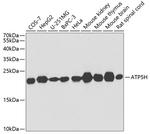 ATP5H Antibody in Western Blot (WB)