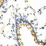 CRTAP Antibody in Immunohistochemistry (Paraffin) (IHC (P))