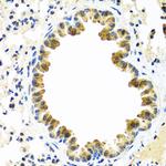 CRTAP Antibody in Immunohistochemistry (Paraffin) (IHC (P))