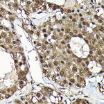 ADRM1 Antibody in Immunohistochemistry (Paraffin) (IHC (P))