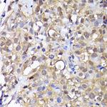 ADI1 Antibody in Immunohistochemistry (Paraffin) (IHC (P))