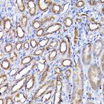 ADI1 Antibody in Immunohistochemistry (Paraffin) (IHC (P))