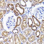 ADI1 Antibody in Immunohistochemistry (Paraffin) (IHC (P))