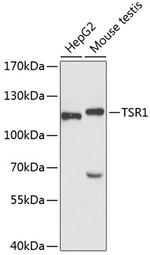 TSR1 Antibody in Western Blot (WB)