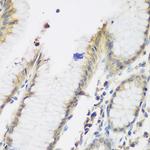 NAT13 Antibody in Immunohistochemistry (Paraffin) (IHC (P))