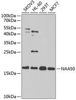 NAT13 Antibody in Western Blot (WB)