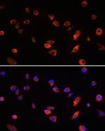 ARL13B Antibody in Immunocytochemistry (ICC/IF)