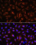 ARL13B Antibody in Immunocytochemistry (ICC/IF)