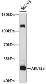 ARL13B Antibody in Western Blot (WB)