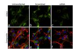 CD63 Antibody in Immunocytochemistry (ICC/IF)