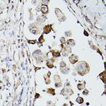 CD63 Antibody in Immunohistochemistry (Paraffin) (IHC (P))