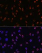 H3K14me2 Antibody in Immunocytochemistry (ICC/IF)