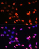 H3K14me2 Antibody in Immunocytochemistry (ICC/IF)