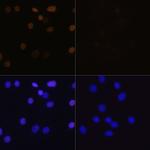 H4K16ac Antibody in Immunocytochemistry (ICC/IF)