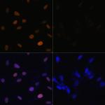 H4K16ac Antibody in Immunocytochemistry (ICC/IF)