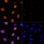 H4K16ac Antibody in Immunocytochemistry (ICC/IF)