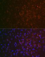 ABAT Antibody in Immunohistochemistry (Paraffin) (IHC (P))