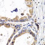 FABP3 Antibody in Immunohistochemistry (Paraffin) (IHC (P))