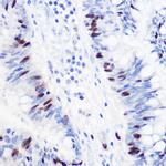 GMNN Antibody in Immunohistochemistry (Paraffin) (IHC (P))