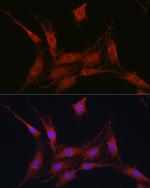 SLC4A4 Antibody in Immunocytochemistry (ICC/IF)