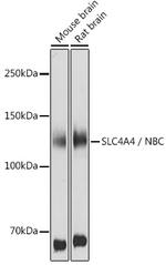 SLC4A4 Antibody in Western Blot (WB)