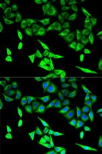 HADHA Antibody in Immunocytochemistry (ICC/IF)